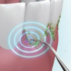 Salle De Bain Et Hygiène-Tempsl Détartreur ultrasons