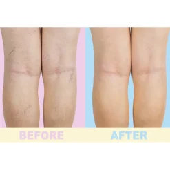 Produits De Beauté|Aide Et Accessoires Confort-Tempsl Gel soin des jambes