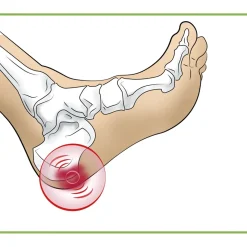 Aide Et Accessoires Confort|Soins Des Pieds Et Accessoires-Tempsl Talonnettes pour épine calcanéenne Modèle femme